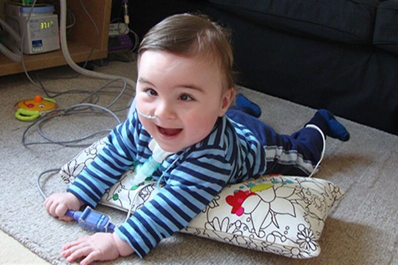 Baby boy lying on his front on a pillow, attached to medical equipment looking up and smiling at camera