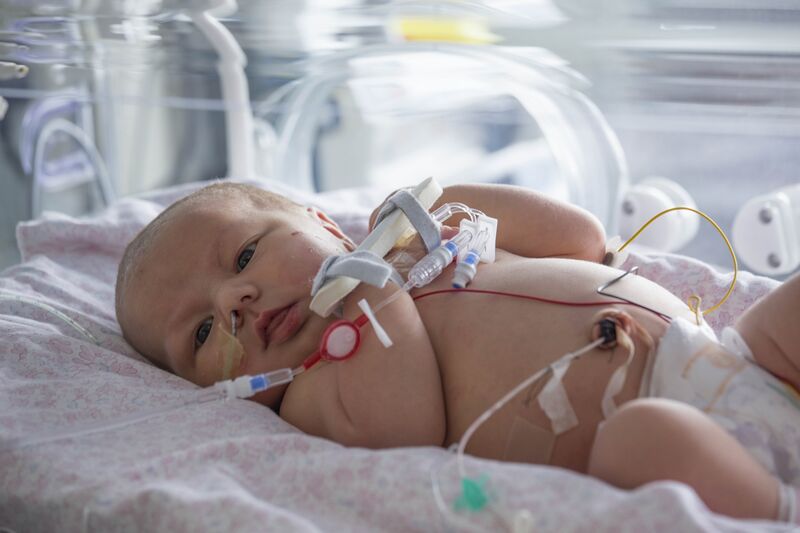 Cute baby lying on its back on a hospital bed attached to tubes while looking at the camera