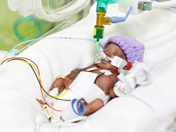 Premature baby in a hospital bed wearing a purple wool hat attached to several tubes