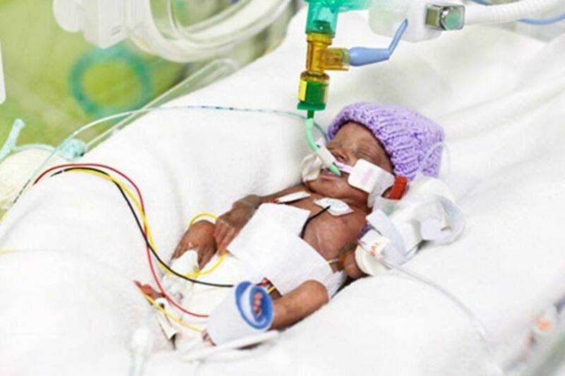 Premature baby in a hospital bed wearing a purple wool hat attached to several tubes