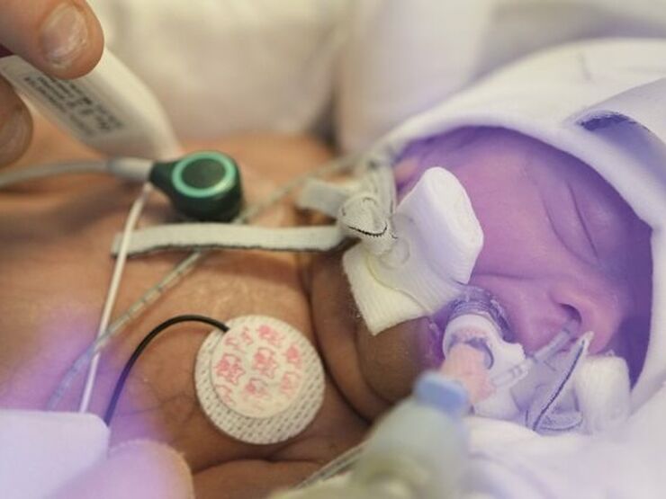 Baby receiving care in hospital through various tubes and machines