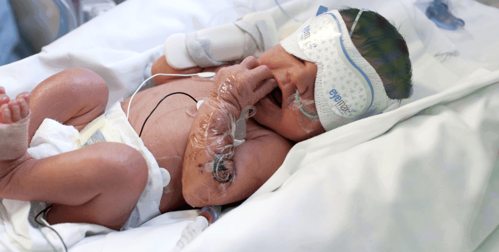 Baby in incubator wearing eye mask and attached to feeding tubes and wires