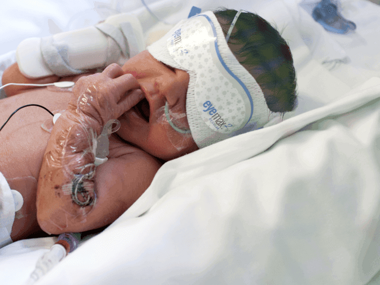 Baby in incubator wearing eye mask and attached to feeding tubes and wires