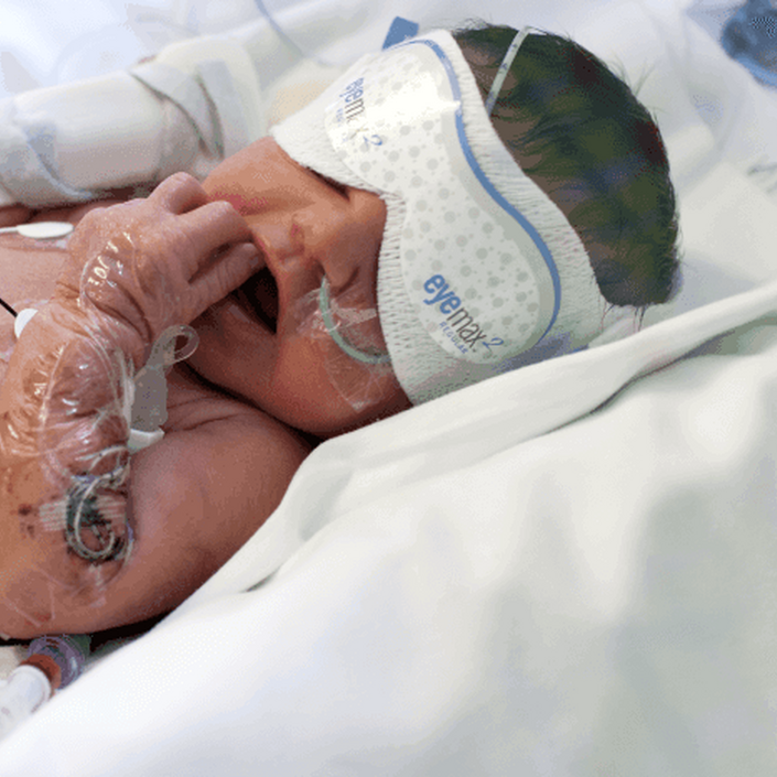 Baby in incubator wearing eye mask and attached to feeding tubes and wires