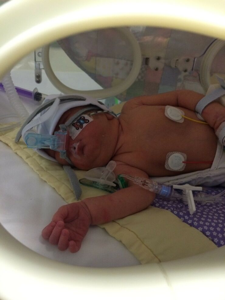 A photo of baby Polly in the incubator