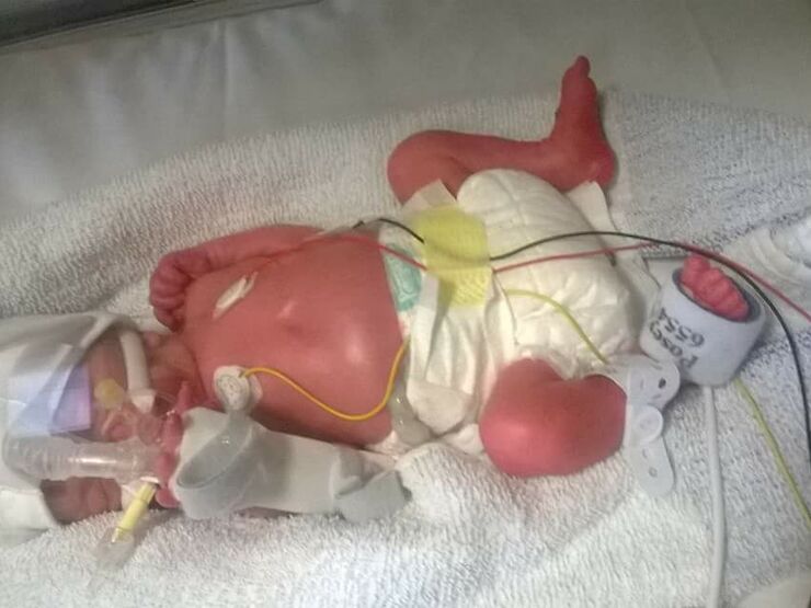 Alexandra's Story Hero