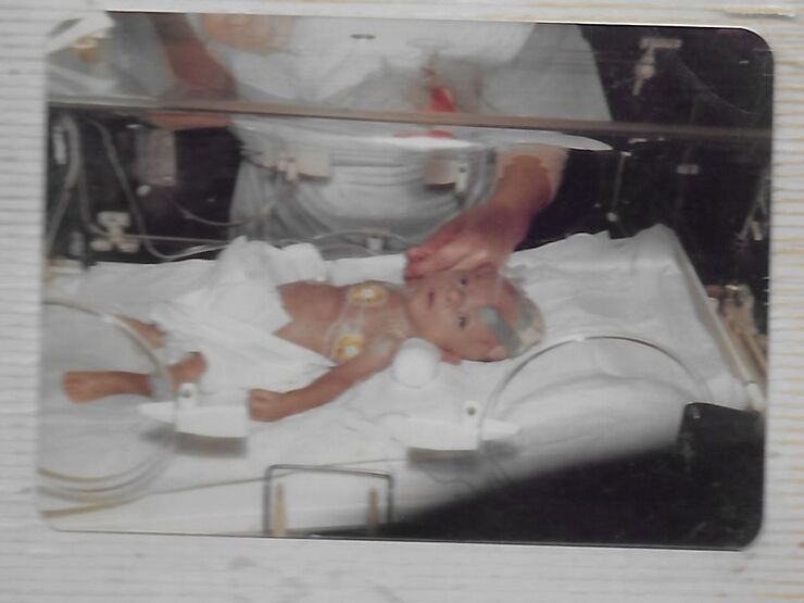 Geoff's Story   What It Was Like To Be Born Premature Hero