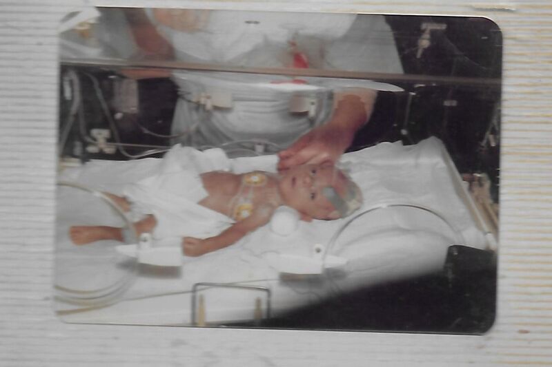 Geoff's Story   What It Was Like To Be Born Premature Hero