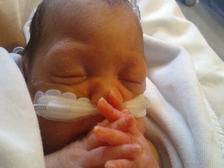 Jessica's Story Hero