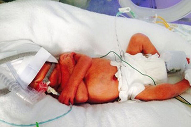 Georgina's Story Hero