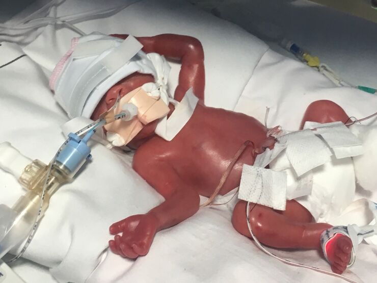 Stephanie's Story Hero