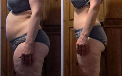 5 Inspiring Over 40 Weight Loss Stories You Need To Read