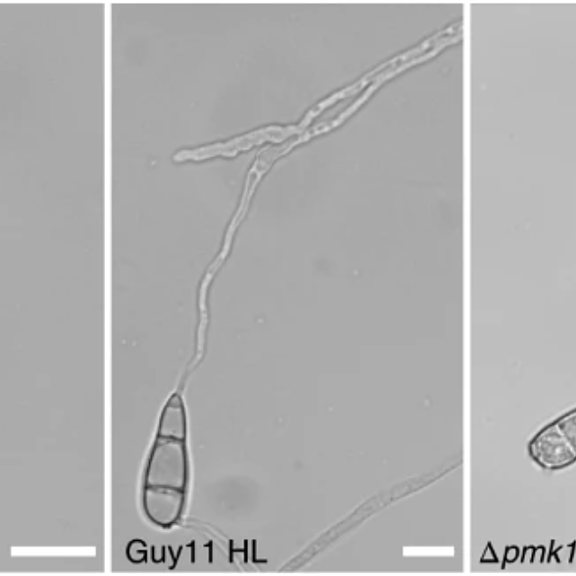 Figure from Oses-Ruiz et al (2021)