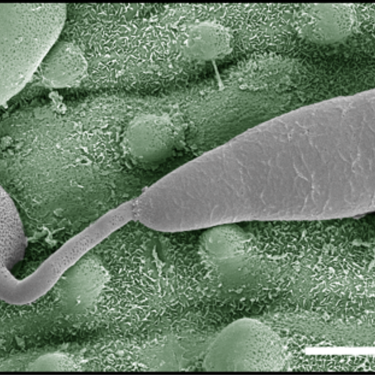 Electron micrograph of a Magnaporthe oryzae appressorium