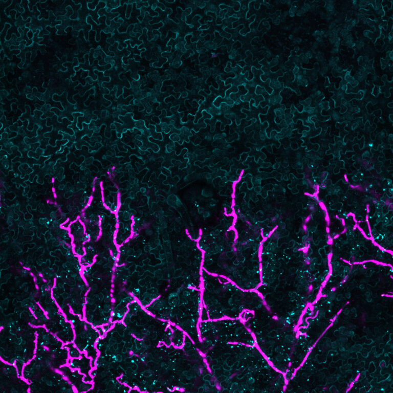 Hyphae of P. infestans invading plant tissue