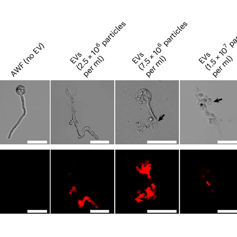 Xu etal 2026 Nat Microbiol
